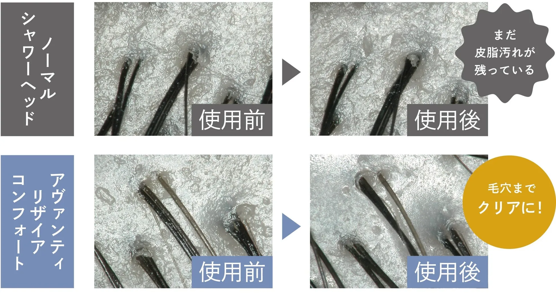 頭皮洗浄イメージ